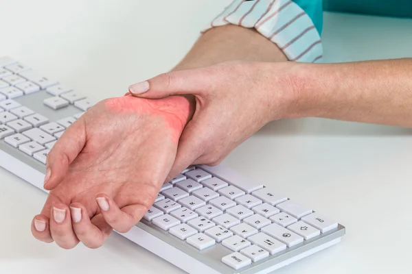 Dolor de muñeca por trabajar con computadora, síndrome del túnel carpiano — Foto de Stock