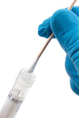 , COVID-19 örnek toplama kiti, OP NP hasta numunesi almak için test tüpü test tamamlandı, hasta korona testi yaptırıyor.