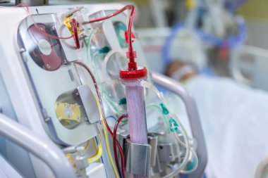 Diyaliz makinesi çalışıyor. Böbreklerin vücuttan atık taşımasının yerine geçiyor..