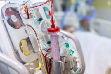 Diyaliz makinesi çalışıyor. Böbreklerin vücuttan atık taşımasının yerine geçiyor..
