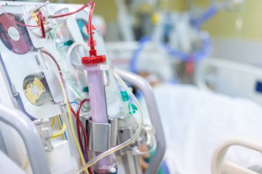 Diyaliz makinesi çalışıyor. Böbreklerin vücuttan atık taşımasının yerine geçiyor..