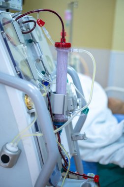 Diyaliz makinesi çalışıyor. Böbreklerin vücuttan atık taşımasının yerine geçiyor..