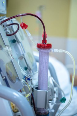 Diyaliz makinesi çalışıyor. Böbreklerin vücuttan atık taşımasının yerine geçiyor..