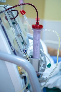 Diyaliz makinesi çalışıyor. Böbreklerin vücuttan atık taşımasının yerine geçiyor..
