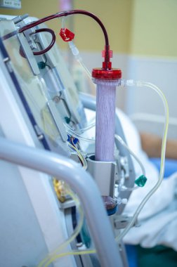 Diyaliz makinesi çalışıyor. Böbreklerin vücuttan atık taşımasının yerine geçiyor..