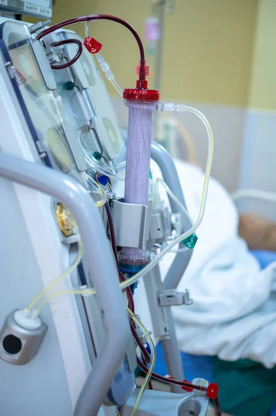 Diyaliz makinesi çalışıyor. Böbreklerin vücuttan atık taşımasının yerine geçiyor..