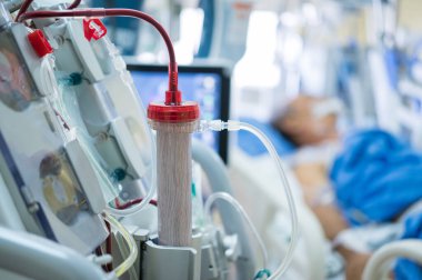 Diyaliz makinesi çalışıyor. Böbreklerin vücuttan atık taşımasının yerine geçiyor..