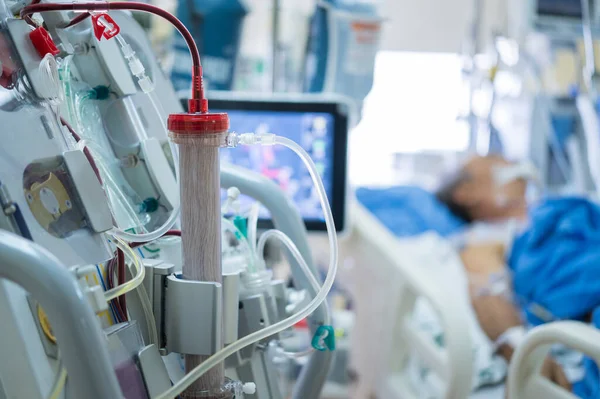 Especialistas Estão Preparando Uma Máquina Diálise Para Uso Pacientes Críticos — Fotografia de Stock