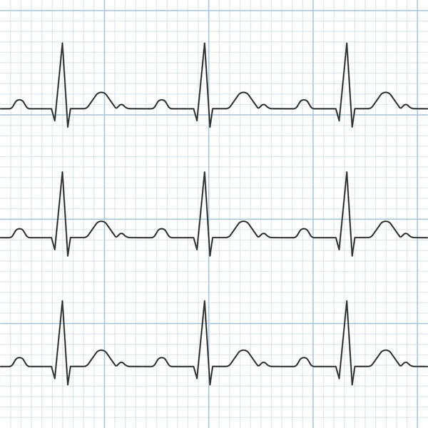 Vektör kardiyogram, düz tasarım — Stok Vektör