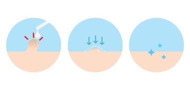 Cilt etiketlerinin kullanılması için yön beyaz arkaplanda çizim ayarlandı. Nasıl kullanılacağını, serumun nasıl kullanılacağını cilt yüzeyindeki akrokorları nasıl temizleyeceğini. Cilt bakımı ve güzellik kavramı