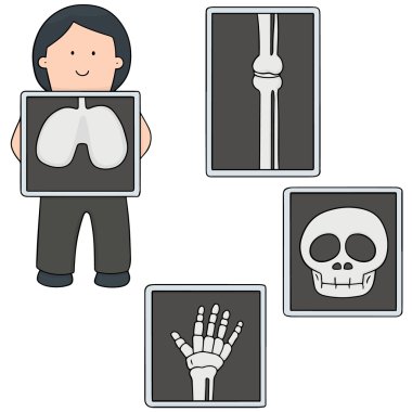 x-ışını vektör kümesi