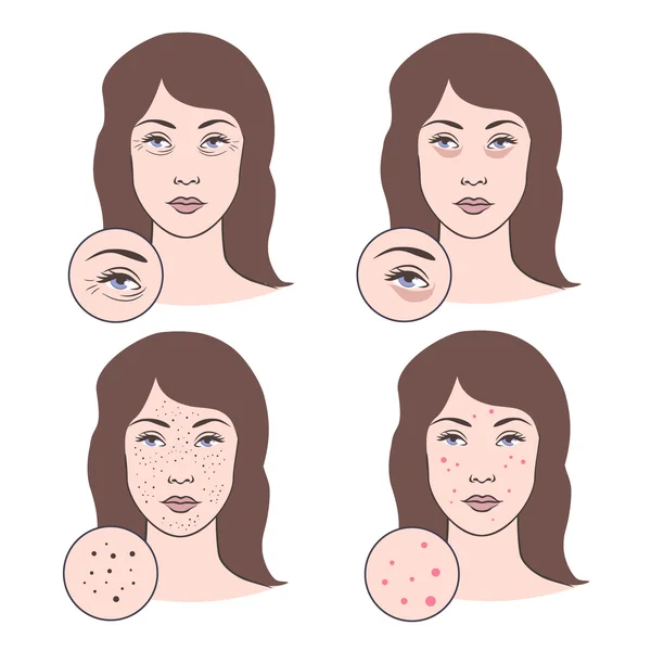 Vector illustration of skin problems — Stock Vector