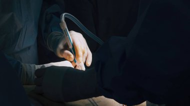 Gelişmiş araç ve tekniklerden yararlanarak, klinik bir ortamda işbirliği ve hassasiyeti vurgulayarak, ayrıntılı cerrahi müdahalede bulunan yetenekli bir sağlık sağlayıcı