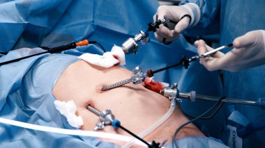 Tıbbi profesyoneller, klinik bir ortamda hassasiyet ve takım çalışmasının önemini vurgulayan özel aletler ve teknikler kullanarak, minimal invazif bir ameliyata giriştiler.