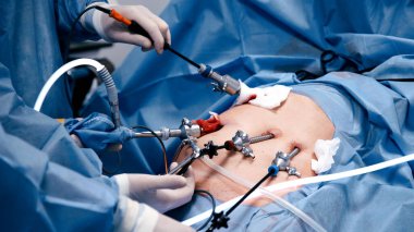 Tıbbi profesyoneller, asgari düzeyde invazif bir ameliyata giriştiler, özel aletler kullandılar ve steril bir ortam sağladılar, prosedür sırasında beceri ve odaklanma gösterdiler.