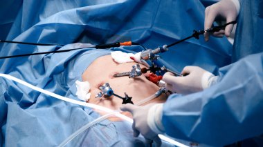 Tıbbi profesyoneller, klinik bir ortamda hassasiyet ve takım çalışmasının önemini vurgulayan özel araçlar ve teknikler kullanarak minimal invazif bir ameliyata giriştiler.