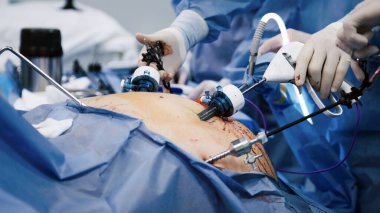 Asgari düzeyde invaziv bir ameliyata girişen tıp uzmanları, robotik araçlardan faydalanıyor ve steril bir ortam korunuyor, gelişmiş teknikler ve işbirliği vurgulanıyor.