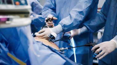 Mavi cerrahi giyimli tıp uzmanları minimal invaziv bir ameliyata girişiyor, gelişmiş aletleri kullanıyorlar ve steril bir ortamda işbirliği gösteriyorlar.