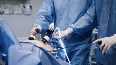 Mavi elbiseli cerrahi ekip, temiz bir ameliyathanede gelişmiş aletlerle işbirliği ve tıbbi uzmanlığı vurgulayan bir prosedüre tabi tutuluyor.