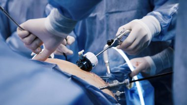Asgari düzeyde invaziv bir ameliyata giren tıp uzmanları, uzmanlaşmış araç ve teknikleri kullanarak steril bir ortamda işbirliği ve hassasiyeti vurguladılar.