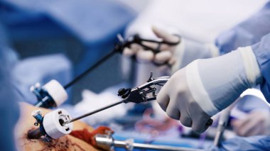 Cerrahi ekip üyesi steril bir ameliyathanede ilerlemiş aletler kullanıyor. Tıbbi pratikteki hassasiyet ve işbirliğinin önemini vurguluyor.