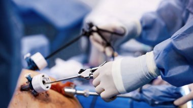 Gelişmiş araçlar ve teknikler kullanarak, steril bir ortamda hassasiyet ve takım çalışmasının önemini vurgulayan, minimal invazif bir ameliyata giren tıp uzmanları