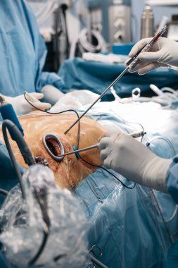 Mavi önlük ve eldiven giyen kalp cerrahı steril bir tıbbi ortamda ameliyat masasının üzerinde cerrahi aletler tutuyor.