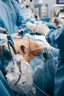 Bir ameliyathanede kalp kapakçığı implantasyonu gerçekleşiyor. Mavi önlüklü bir tıbbi ekip ve hastanın etrafına yerleştirilmiş çeşitli cerrahi aletler.