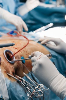 Eldiven takan kalp cerrahı ameliyat sırasında ameliyat aletini kullanır. Ameliyat masasında kan ve cerrahi aletler bulunur.