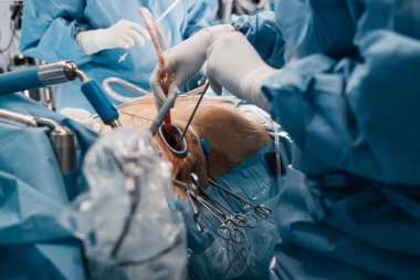 Açık kalp ameliyatında kalp kapakçığı implantasyonu yapılır, steril bir ameliyathanede cerrahi aletler ve tıbbi personel sergilenir.