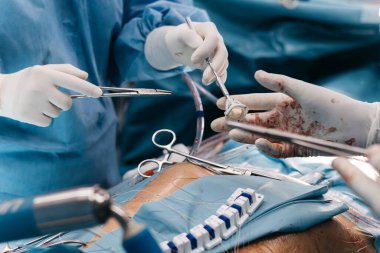 Açık kalp ameliyatında kalp kapakçığı implantasyonu yapılır, steril bir ameliyathanede cerrahi aletler ve tıbbi personel sergilenir.