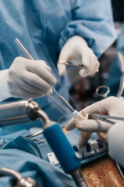 Kalp kapakçığı implantasyonu bir ameliyathanede yapılır, cerrahi aletler sergilenir ve mavi önlüklü tıbbi personelle steril bir ortam sağlanır.