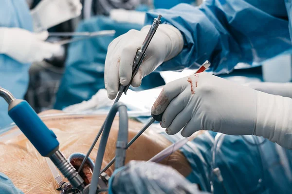 Eldiven ve mavi önlük giyen kalp cerrahı ameliyat masasında ameliyat aletleri tutuyor. Arka planda tıbbi aletler ve ekipmanlar var.