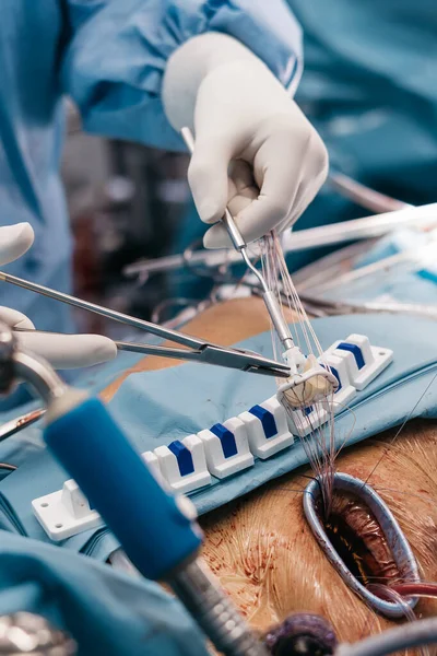 Kalp kapakçığı implantasyonu ameliyathanede yapılır, cerrahi aletler sergilenir ve masada tıbbi personeli olan bir hasta bulunur.