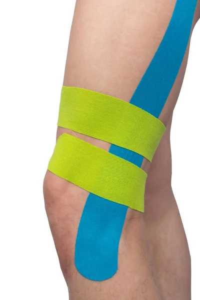 Auf Weißem Hintergrund Wird Das Knie Mit Kinesio Bändern Verklebt — Stockfoto