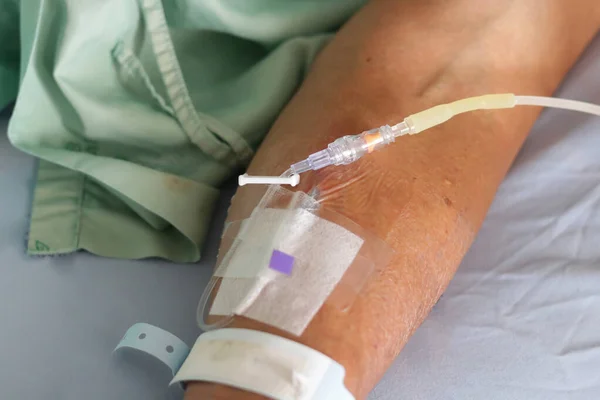 Закрыть Руки Пациентов Больнице Физраствором Внутривенно — стоковое фото