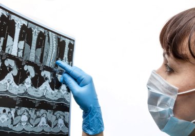 Doktor akciğer radyografisini inceliyor.