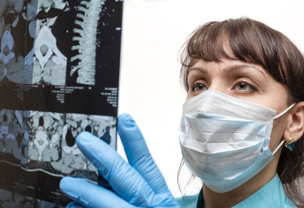 Arzt untersucht Lungenröntgenbild — Stockfoto