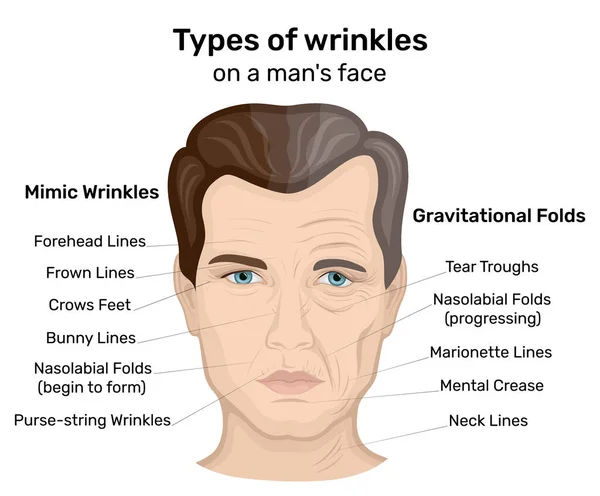 Illustration Two Types Wrinkles Expression Gravity Man Face One Half — Stock Vector