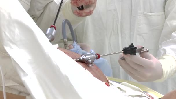 Медицинская операция в больнице — стоковое видео