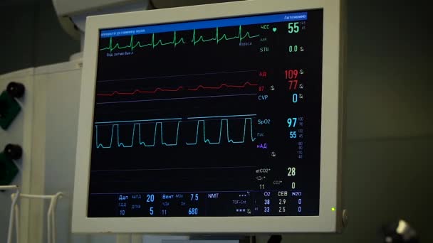 Der Monitor im Operationssaal — Stockvideo
