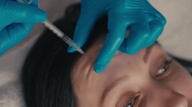 Doktor-kozmetik uzmanının yakın çekimi botulinum toksini alnına enjeksiyon yapıyor..