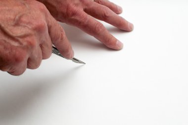 Sanatçı bir neşter ile el kesme mans