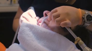 Dişlerini ölçekli ve temizlenmiş olan bir adam itin