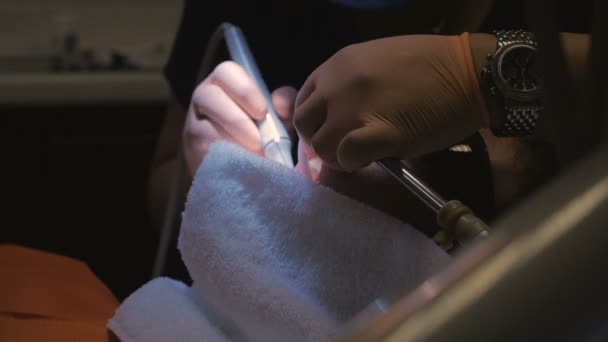 Een tandarts met beide handen op de schaal van een patiënt tanden — Stockvideo