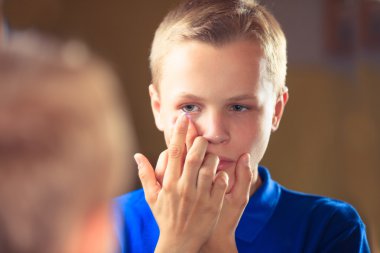 Kontakt lens, erkek gözüyle yakın çekim