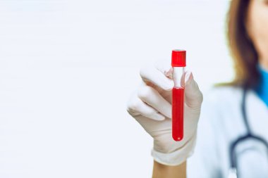 Virüsler, mantarlar ve hastalıklar için tıbbi testler.