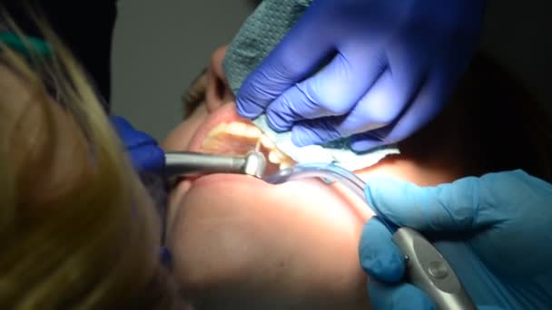 Dentist Treats Teeth Woman — Stock Video