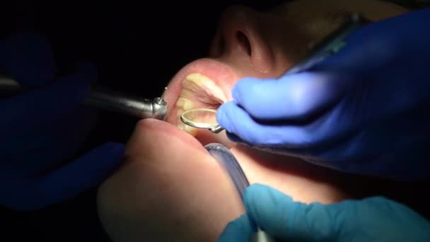Dentista Trata Los Dientes Mujer — Vídeo de stock