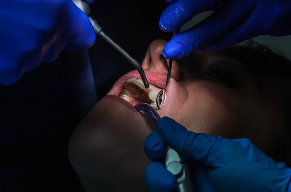 Médico Dentista Trata Los Dientes Mujer — Foto de Stock